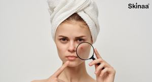Say Goodbye to Acne: Proven Skincare Tips for Clearer Skin