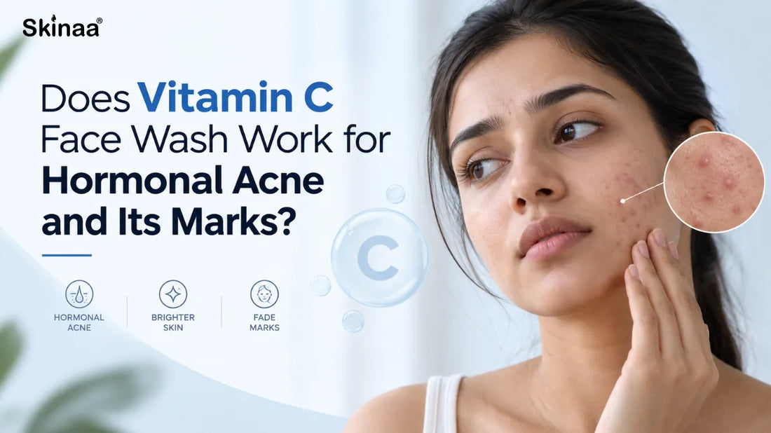 Does Vitamin C Face Wash Work for Hormonal Acne and Its Marks?