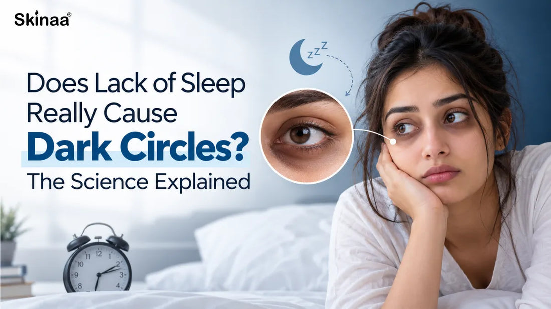 Does Lack of Sleep Really Cause Dark Circles? The Science Explained
