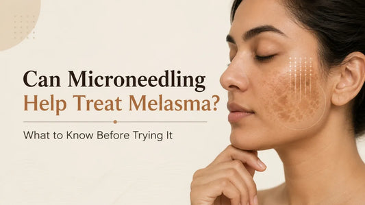 Can Microneedling Help Treat Melasma? What to Know Before Trying It