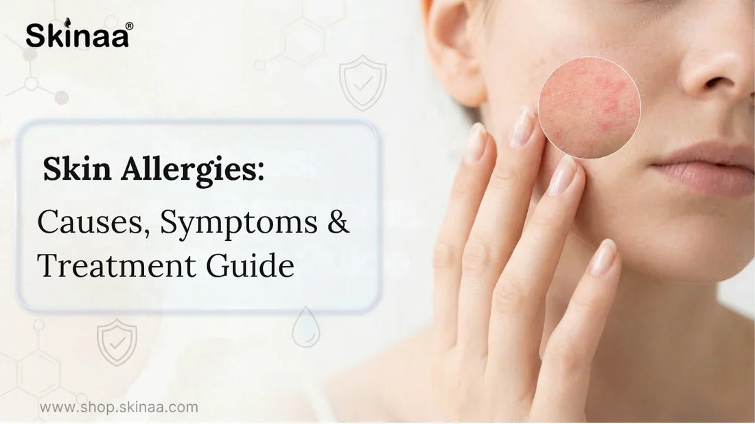 Skin Allergies: Causes, Symptoms & Treatment Guide