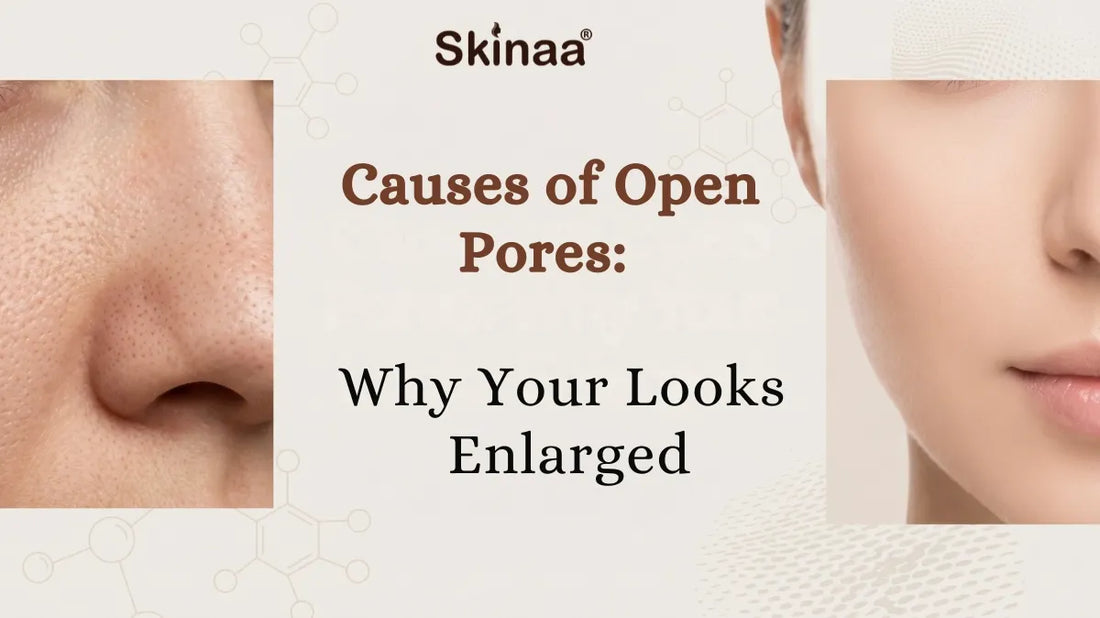 Causes of Open Pores: Why Your Skin Looks Enlarged