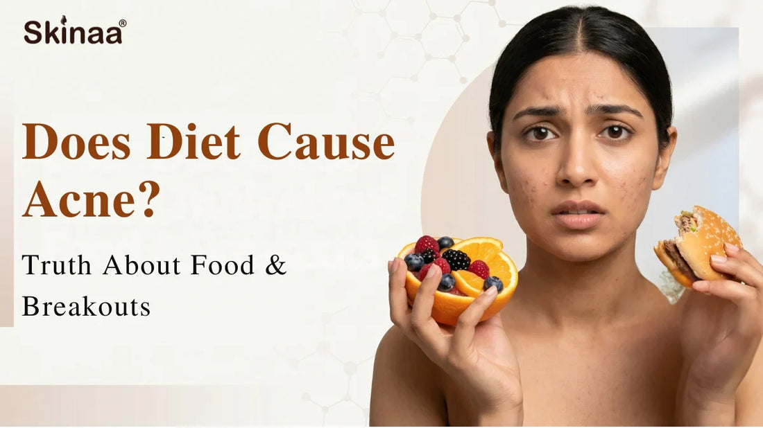 Does diet cause acne