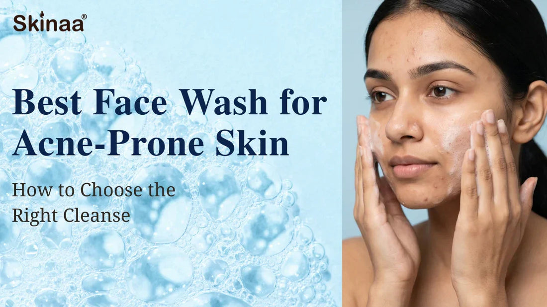 Best facewash for acne prone skin
