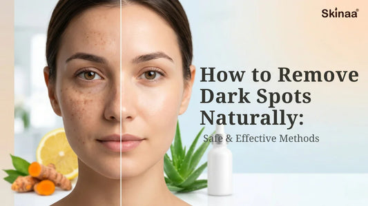 how to remove dark spots naturally