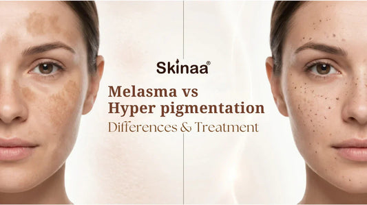 Melasma vs Hyperpigmentation: Differences & Treatment