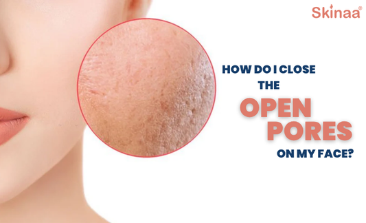 How Do I Close the Open Pores on My Face?