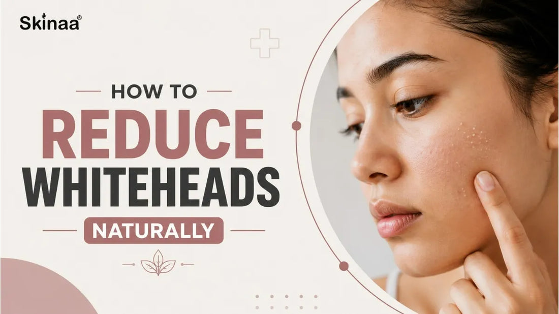 How to Reduce Whiteheads Naturally?