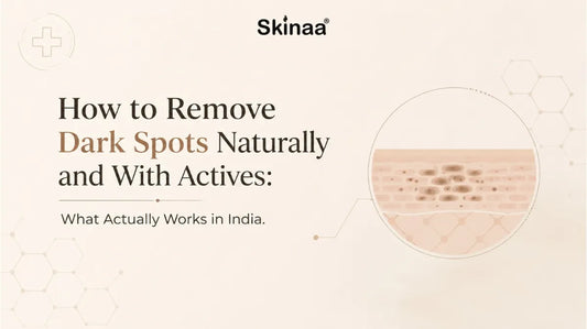 How to Remove Dark Spots Naturally and With Actives: What Actually Works in India