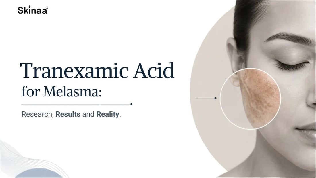 Tranexamic Acid for Melasma: Research, Results and Reality