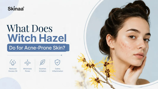What Does Witch Hazel Do for Acne-Prone Skin?