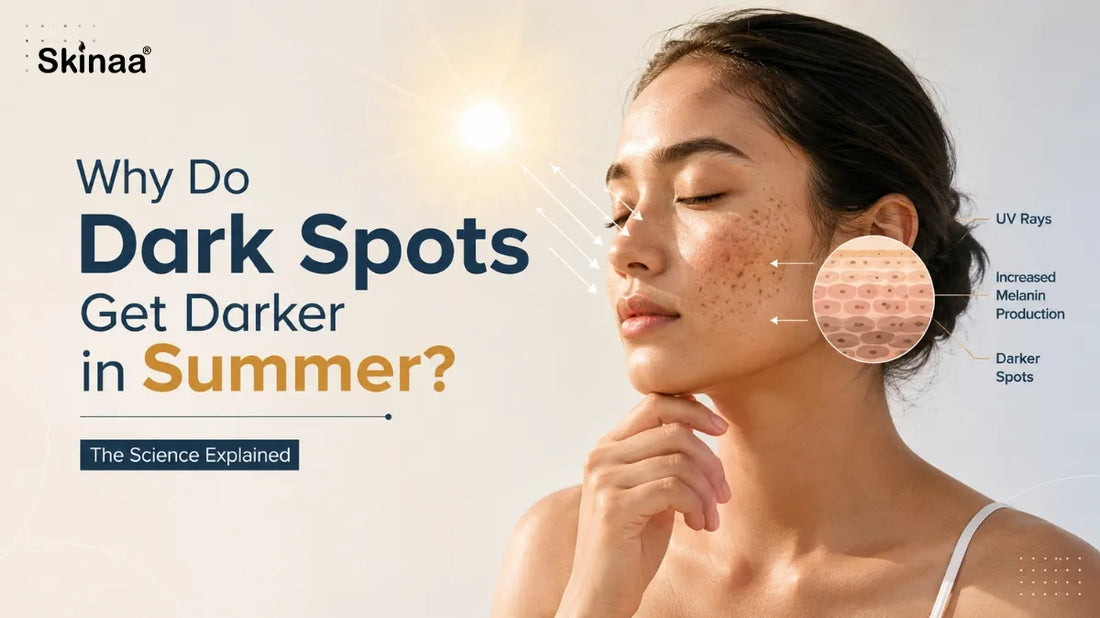 Why Do Dark Spots Get Darker in Summer? The Science Explained