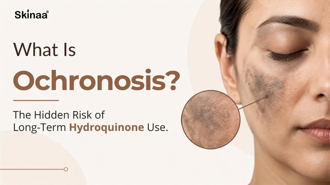 What Is Ochronosis? The Hidden Risk of Long-Term Hydroquinone Use