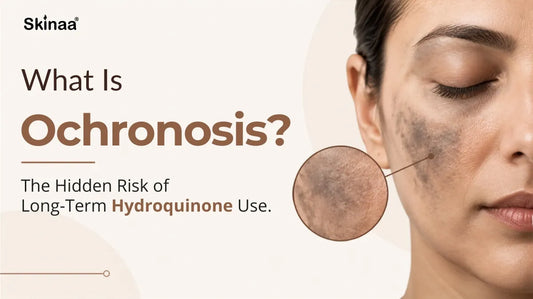 What Is Ochronosis? The Hidden Risk of Long-Term Hydroquinone Use