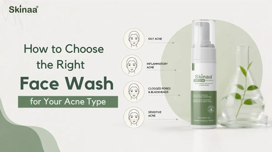How to Choose the Right Face Wash for Your Acne Type