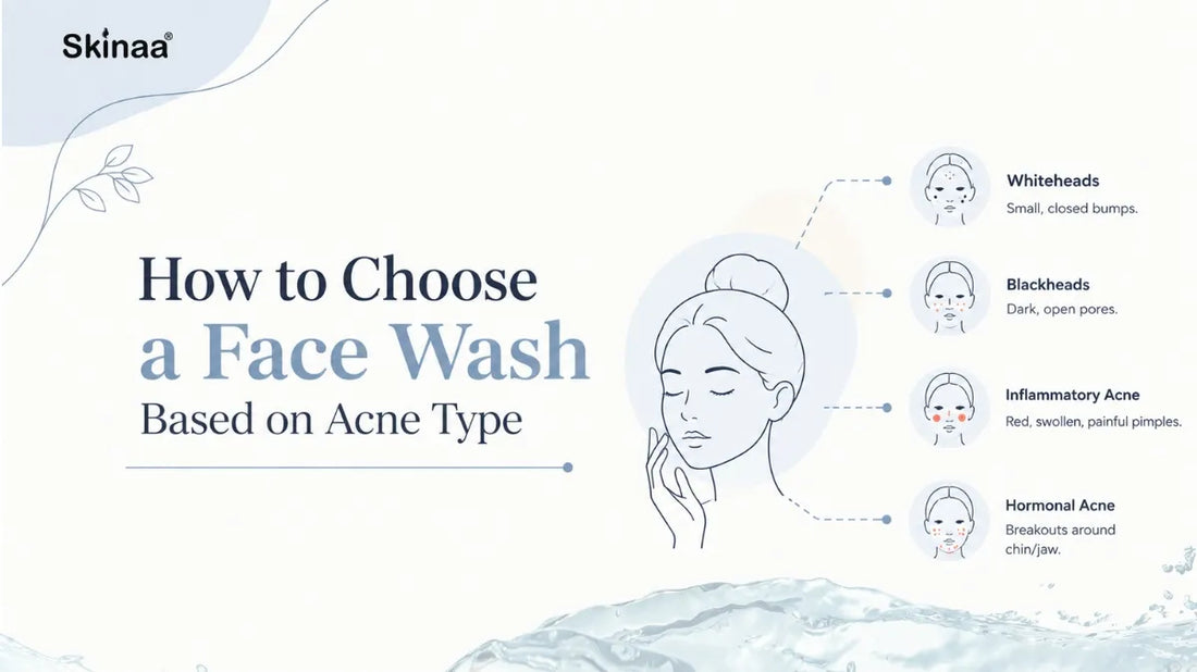 Guide to choosing the right face wash for different acne types like whiteheads, blackheads, and hormonal acne.