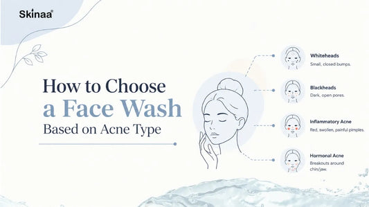 Guide to choosing the right face wash for different acne types like whiteheads, blackheads, and hormonal acne.