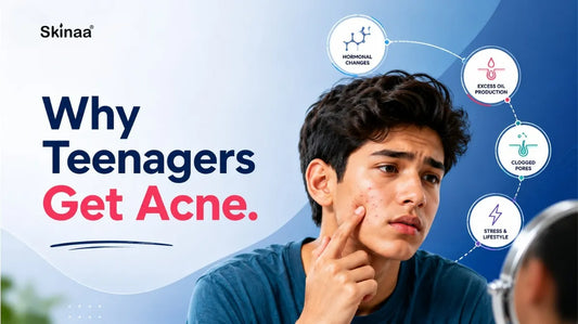 Why teenagers get acne due to hormones, excess oil, and clogged pores.