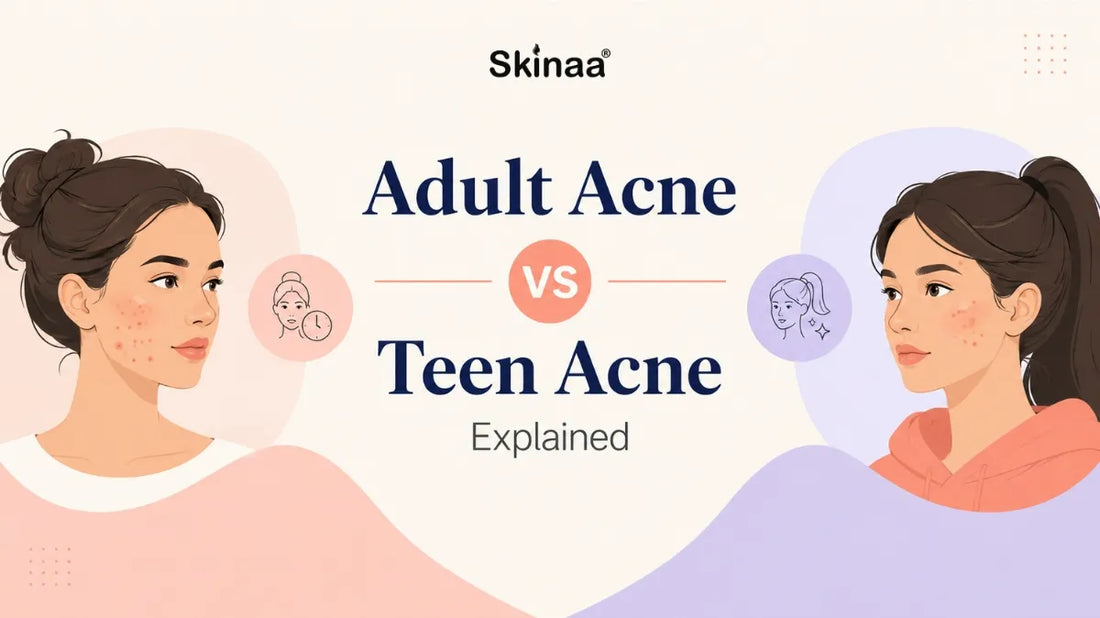 Adult Acne vs Teen Acne Explained