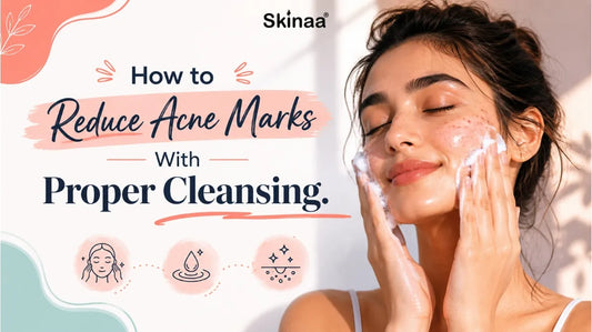 How to Reduce Acne Marks With Proper Cleansing