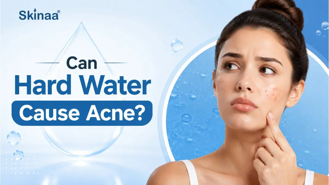 Can Hard Water Cause Acne?