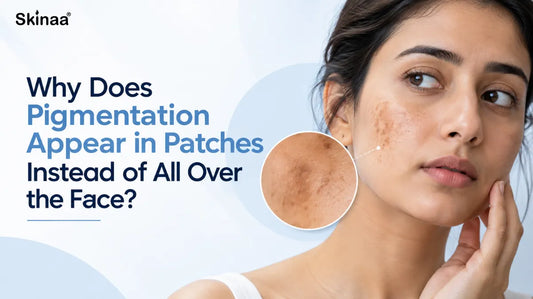 Why Does Pigmentation Appear in Patches Instead of All Over the Face?