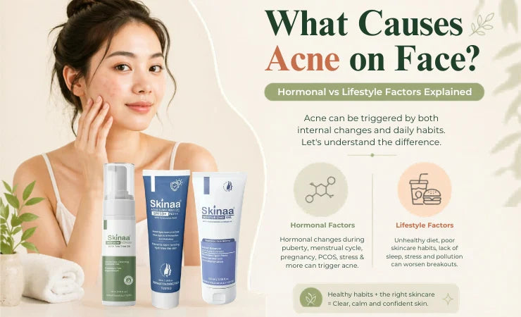 What Causes Acne on Face