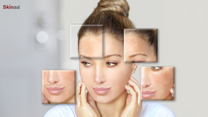 The Importance of Understanding Your Skin Type for Skincare