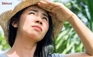 Why You Need Sunscreen and How to Use It