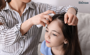 How to Get Rid of Lice in Hair?