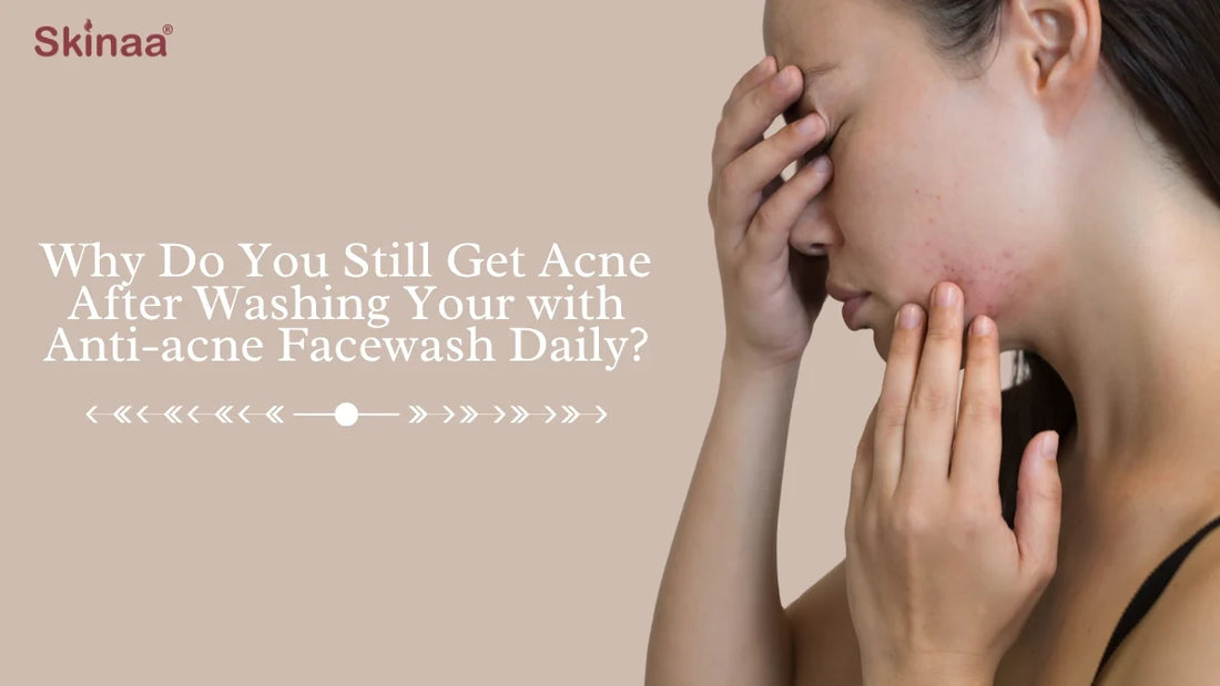Why Do You Still Get Acne After Washing Your Face with Anti-Acne Facewash Daily?