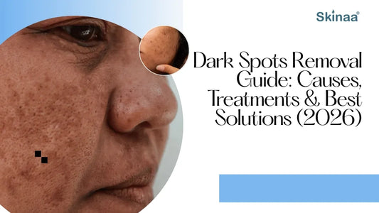 Dark Spots Removal Guide: Causes, Treatments & Best Solutions (2026)