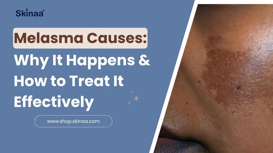 Melasma Causes: Why It Happens & How to Treat It Effectively