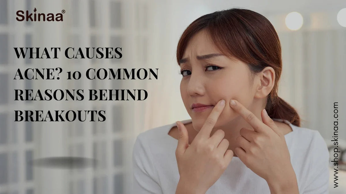 What Causes Acne? 10 Common Reasons Behind Breakouts