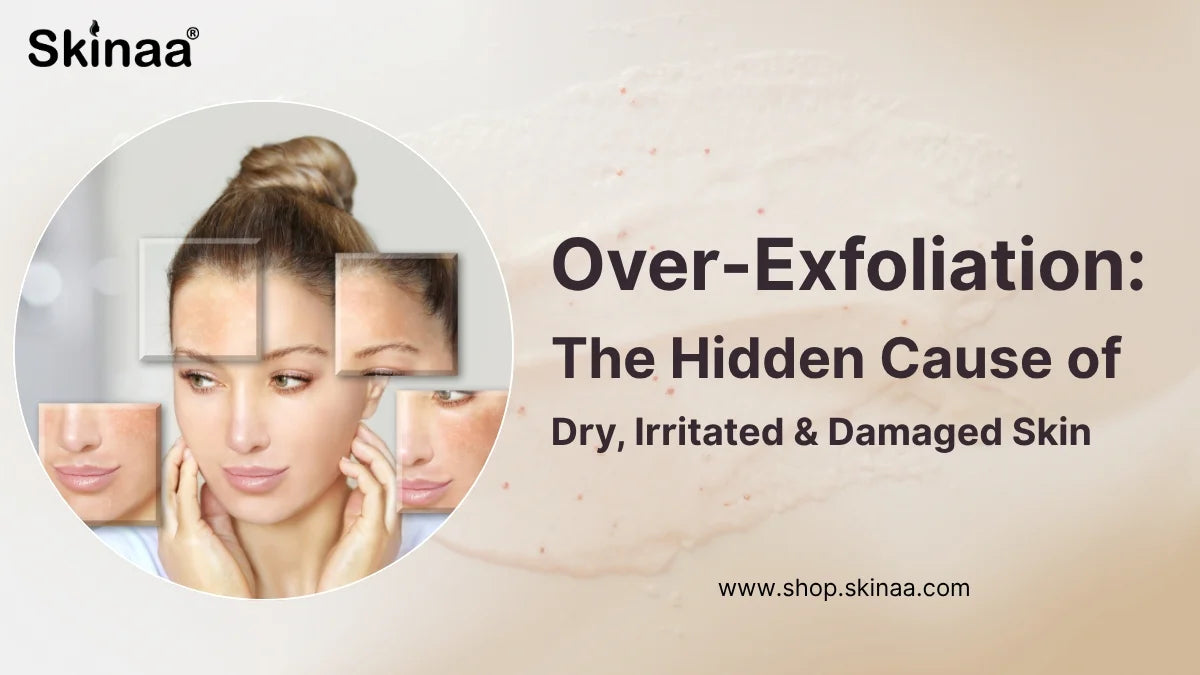 Over-Exfoliation: The Hidden Cause of Dry, Irritated & Damaged Skin ...