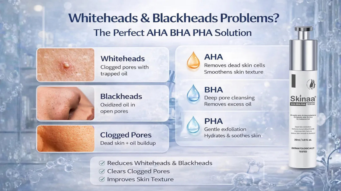 Whiteheads & Blackheads Problems? Here’s the Perfect AHA BHA Solution