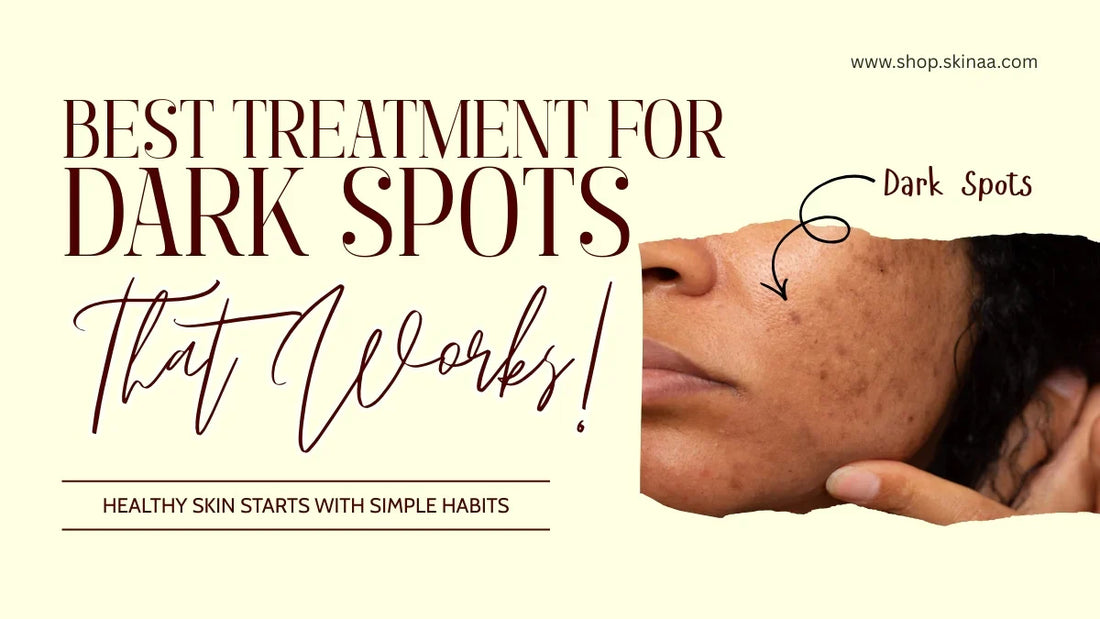 Best Treatments for Dark Spots That Actually Works