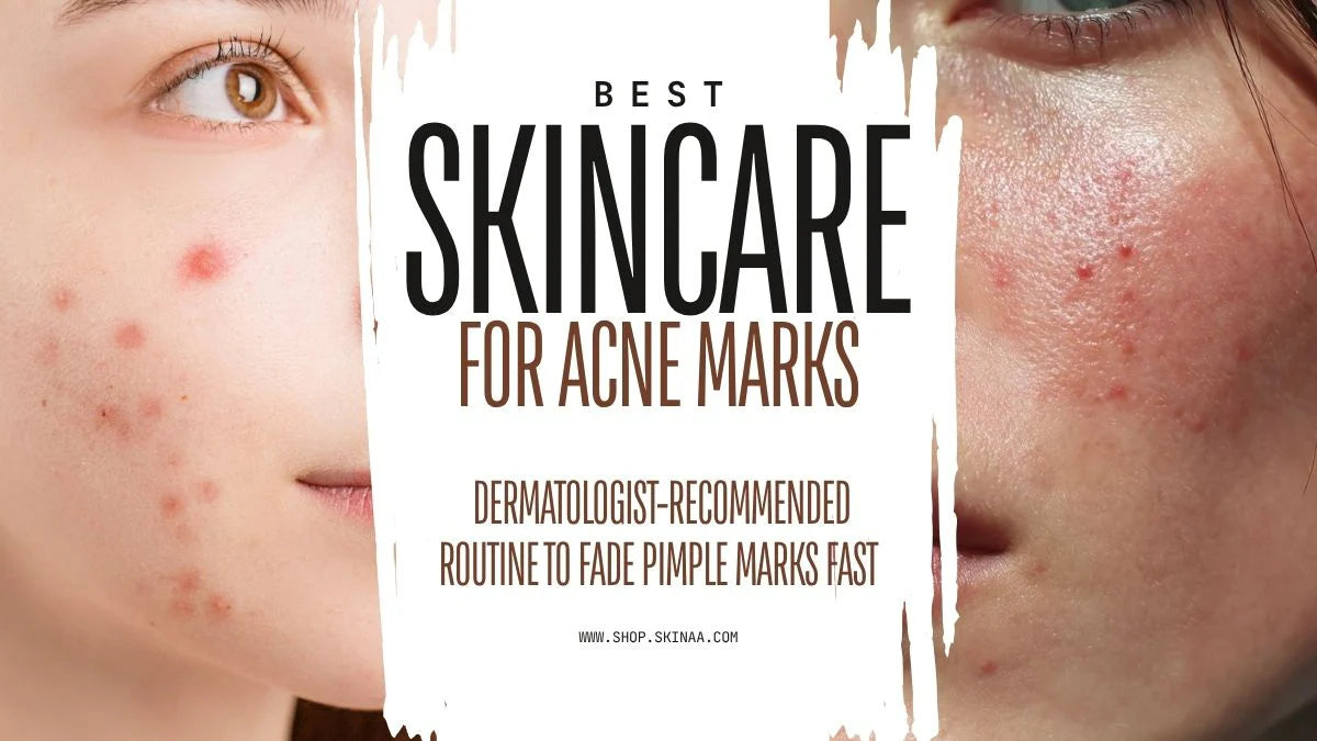 Best Skincare for Acne Marks: Dermatologist-Recommended Routine to Fad ...