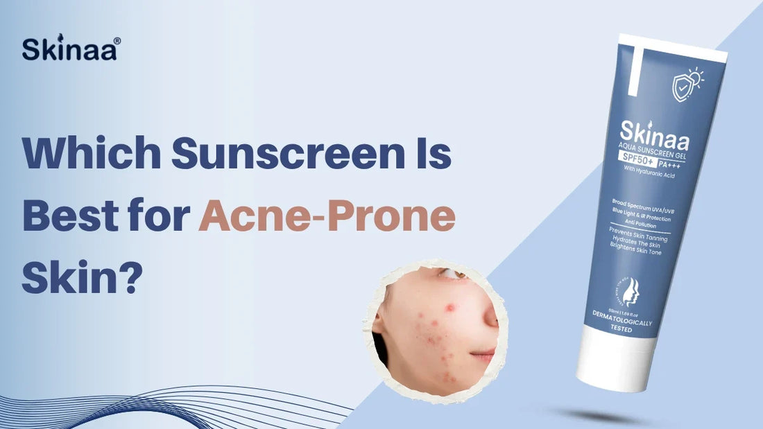Which Sunscreen Is Best for Acne-Prone Skin?