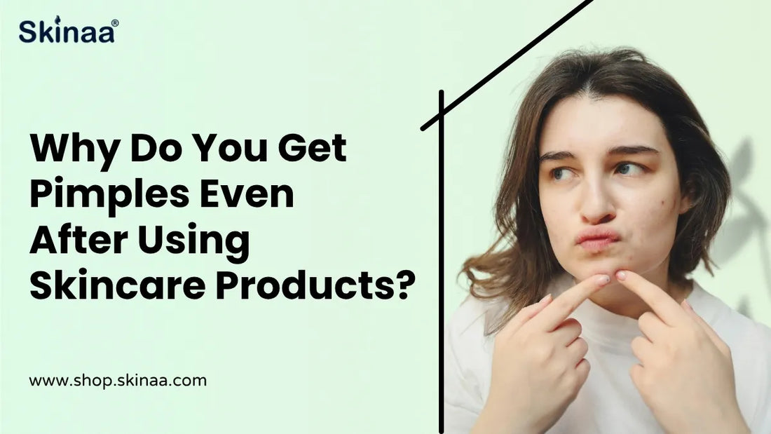 Why Do You Get Pimples Even After Using Skincare Products?