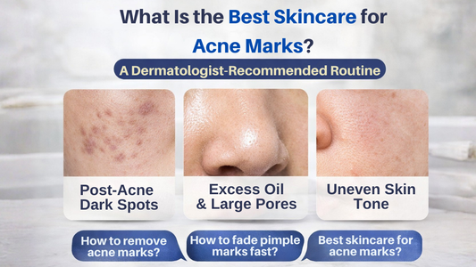 What Is the Best Skincare for Acne Marks? A Dermatologist-Recommended Routine