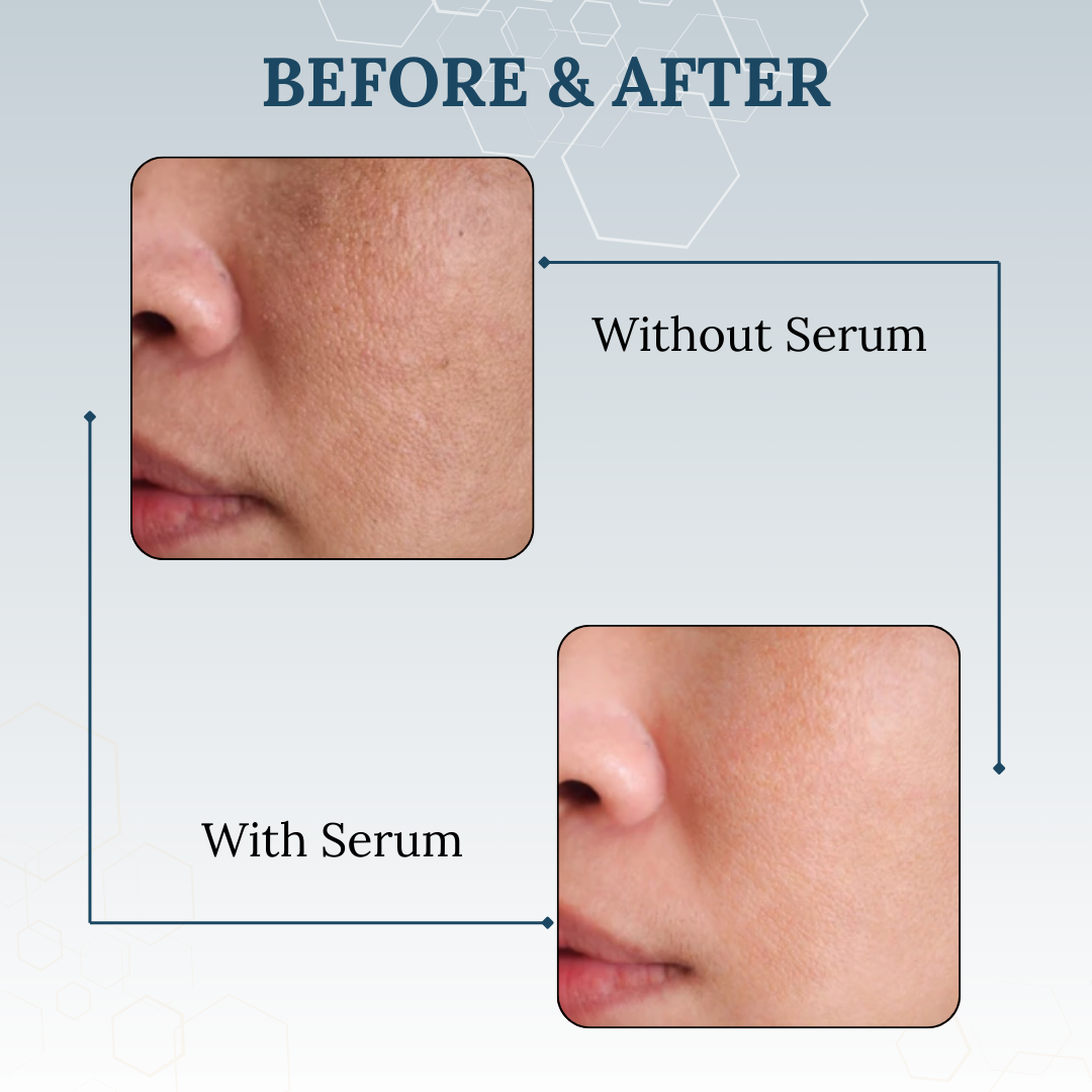 Skinaa 2% Hyaluronic Acid Serum for Deep Hydration & Plumping Face Serum | 30 ml