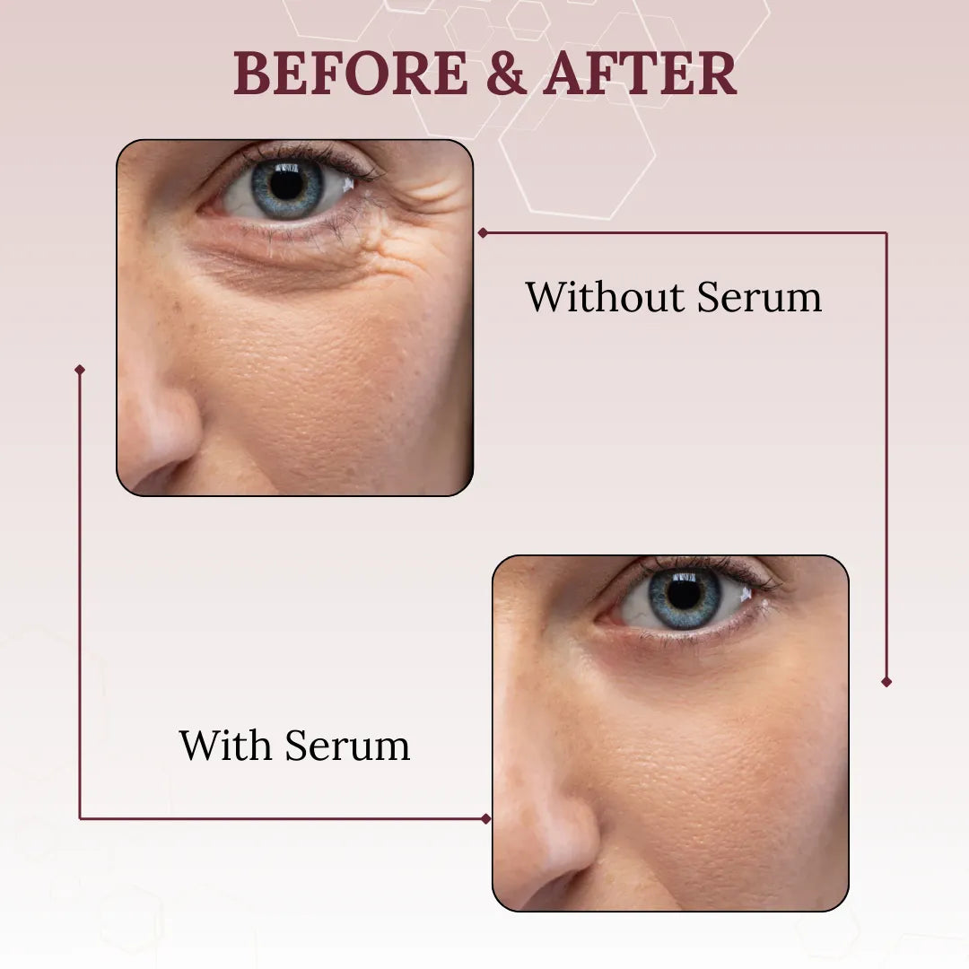 Skinaa Retinol Anti Aging Serum | Face Serum for Wrinkles, Fine Lines & Open Pores | 30 ml