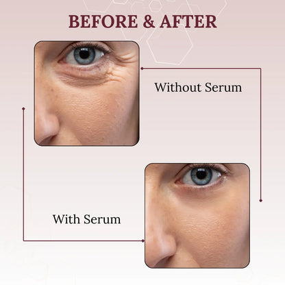 Skinaa Retinol Anti Aging Serum | Face Serum for Wrinkles, Fine Lines & Open Pores | 30 ml