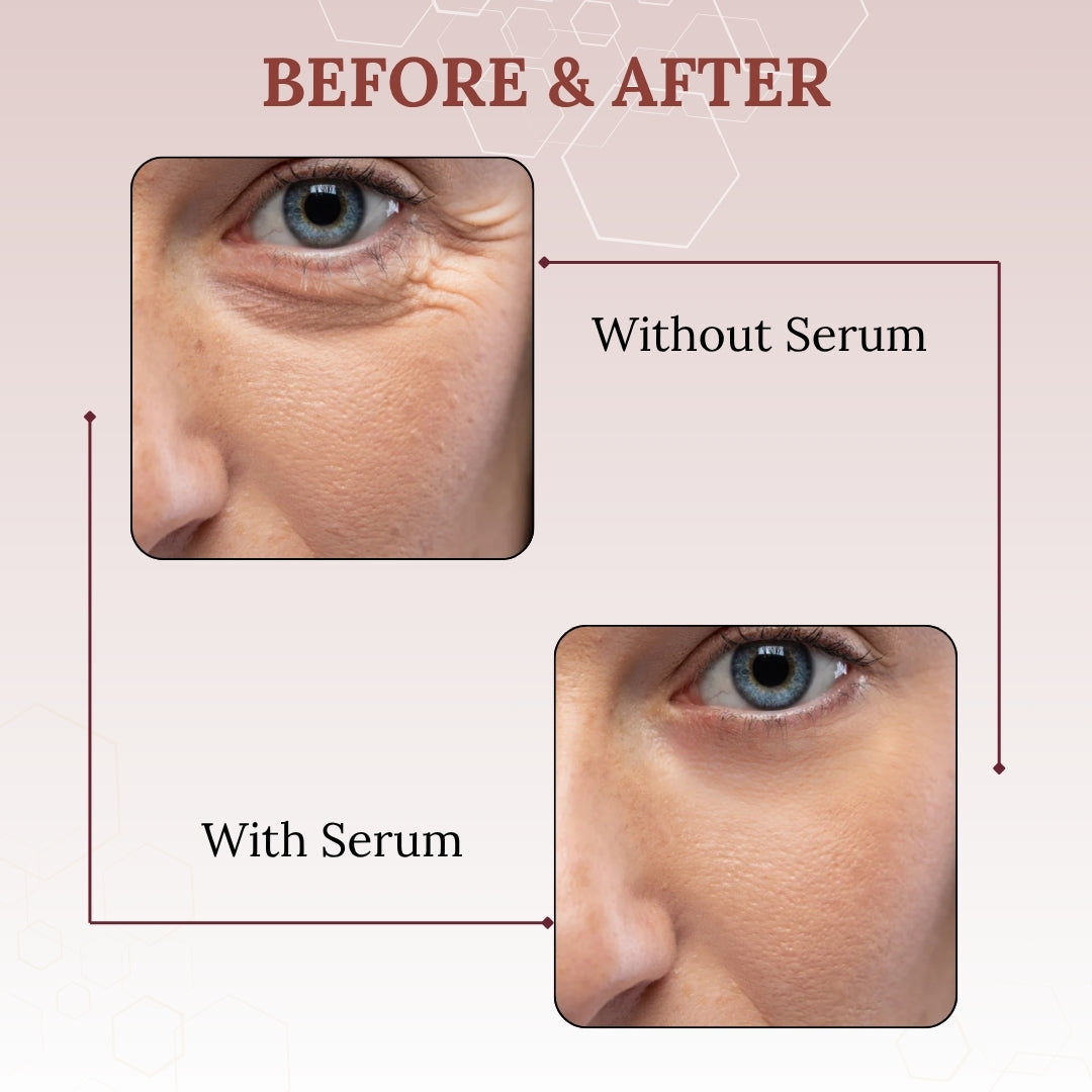 Skinaa Retinol Anti Aging Serum | Face Serum for Wrinkles, Fine Lines & Open Pores | 30 ml