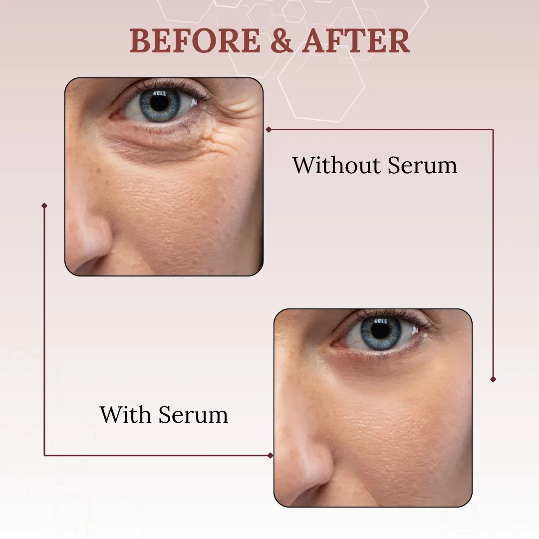 Skinaa Retinol Anti Aging Serum | Face Serum for Wrinkles, Fine Lines & Open Pores | 30 ml