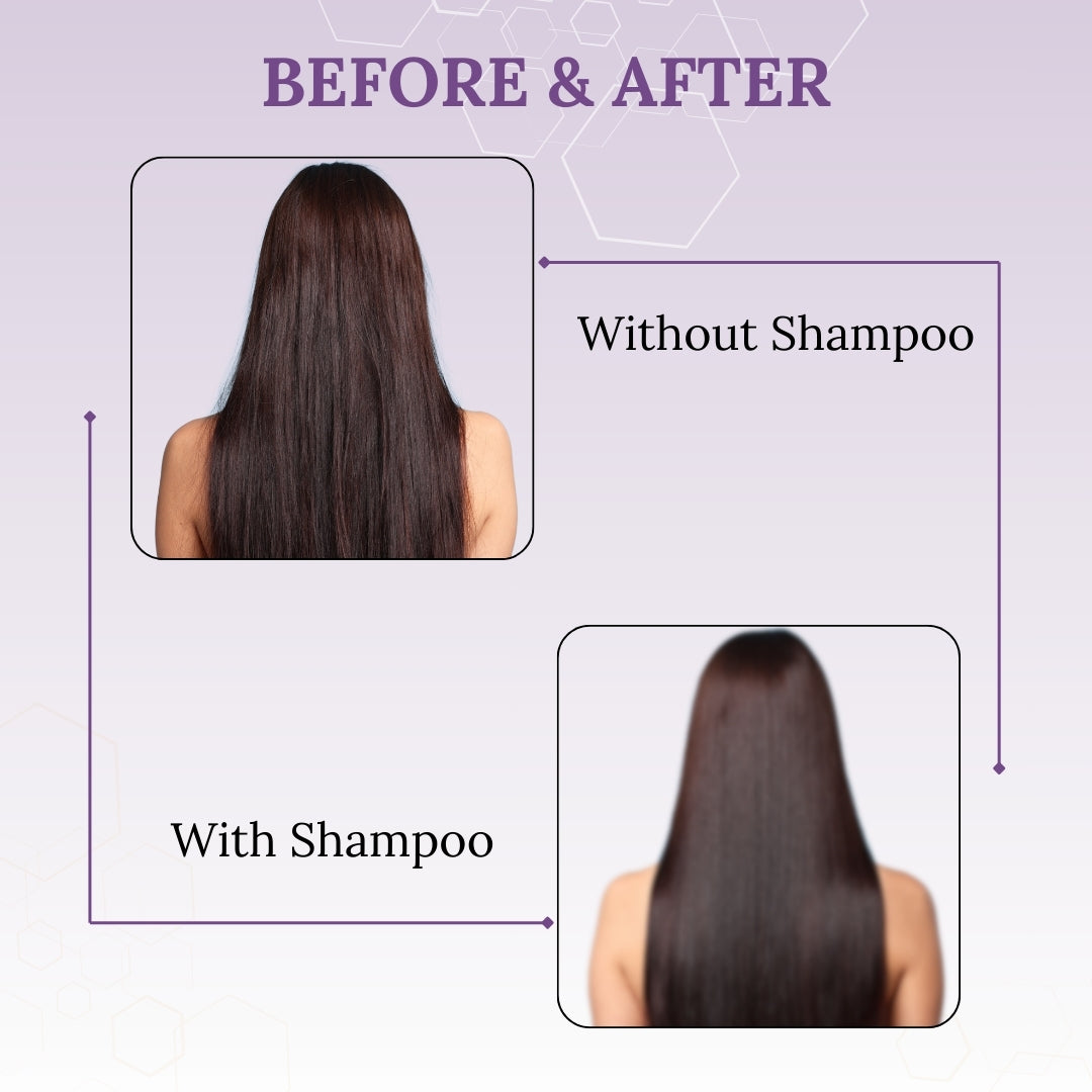 Skinaa Everyday Hair Growth Shampoo | Anti Hair Fall & Hair Strengthening | 200 ml