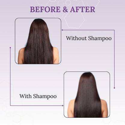 Skinaa Everyday Hair Growth Shampoo | Anti Hair Fall & Hair Strengthening | 200 ml