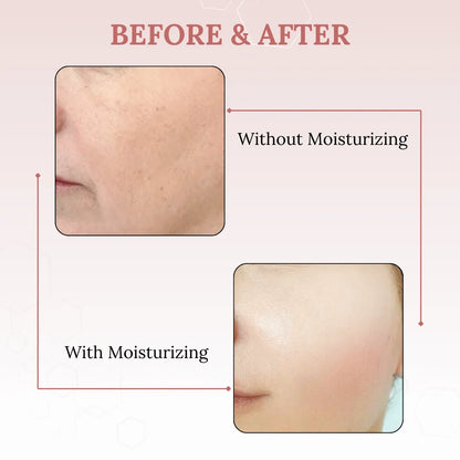 Skinaa Moisturizing Cream | Deep Hydration & Skin Barrier Repair | 100 g