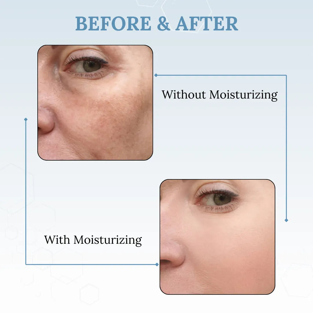 Skinaa Moisturizing Emulsion for Skin Barrier Repair & Long-Lasting Hydration | 100 g